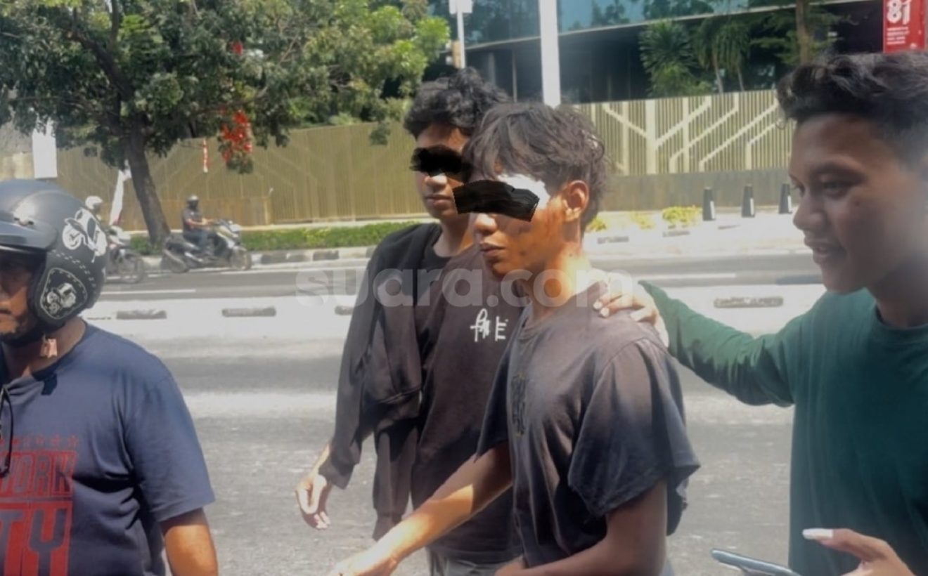 Cerita Siswa MA Pejompongan Dianiaya Kelompok Ngaku Intel, Dipukul Pakai Besi di Depan Rumah