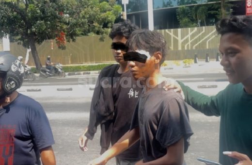 Cerita Siswa MA Pejompongan Dianiaya Kelompok Ngaku Intel, Dipukul Pakai Besi di Depan Rumah