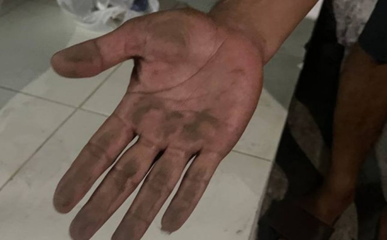 Paparan Abu Vulkanik, 2 Warga Serang Dirujuk ke Rumah Sakit