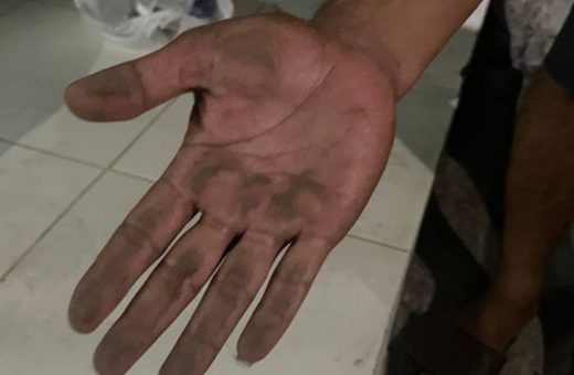 Paparan Abu Vulkanik, 2 Warga Serang Dirujuk ke Rumah Sakit