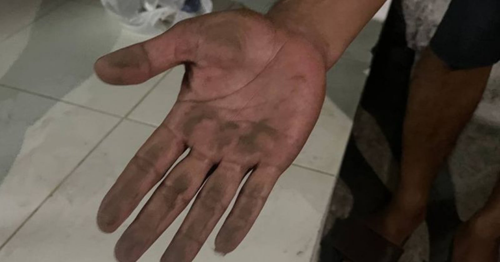 Paparan Abu Vulkanik, 2 Warga Serang Dirujuk ke Rumah Sakit
